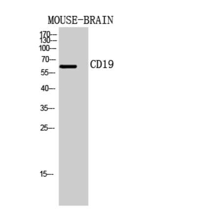 Western blot - CD19 Polyclonal Antibody from Signalway Antibody (41946) - Antibodies.com