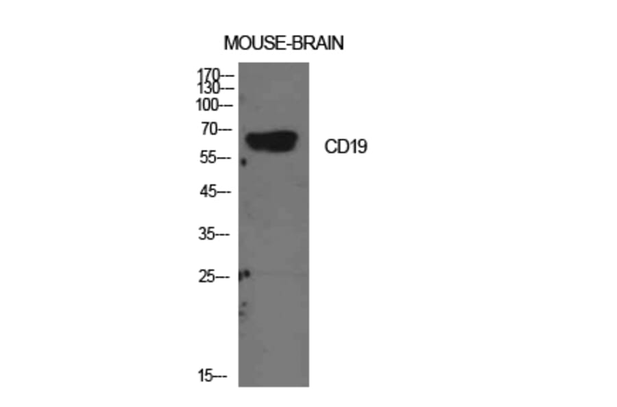 Western blot - CD19 Polyclonal Antibody from Signalway Antibody (41946) - Antibodies.com