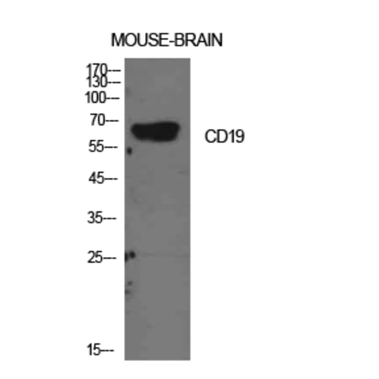 Western blot - CD19 Polyclonal Antibody from Signalway Antibody (41946) - Antibodies.com