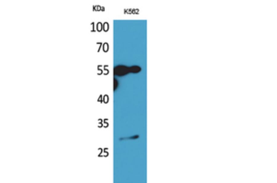 Western blot - CD20 Polyclonal Antibody from Signalway Antibody (41947) - Antibodies.com