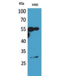 Western blot - CD20 Polyclonal Antibody from Signalway Antibody (41947) - Antibodies.com