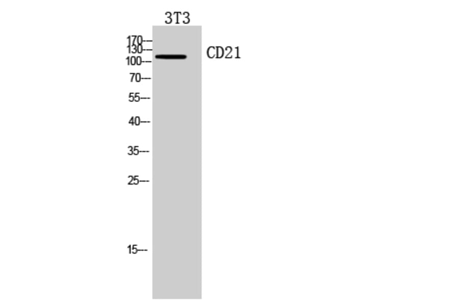 Western blot - CD21 Polyclonal Antibody from Signalway Antibody (41948) - Antibodies.com
