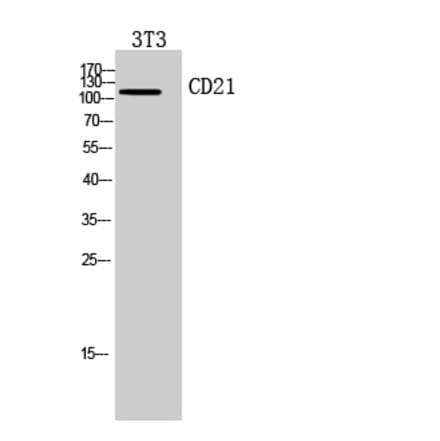 Western blot - CD21 Polyclonal Antibody from Signalway Antibody (41948) - Antibodies.com
