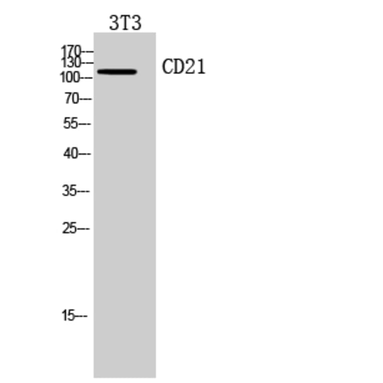 Western blot - CD21 Polyclonal Antibody from Signalway Antibody (41948) - Antibodies.com