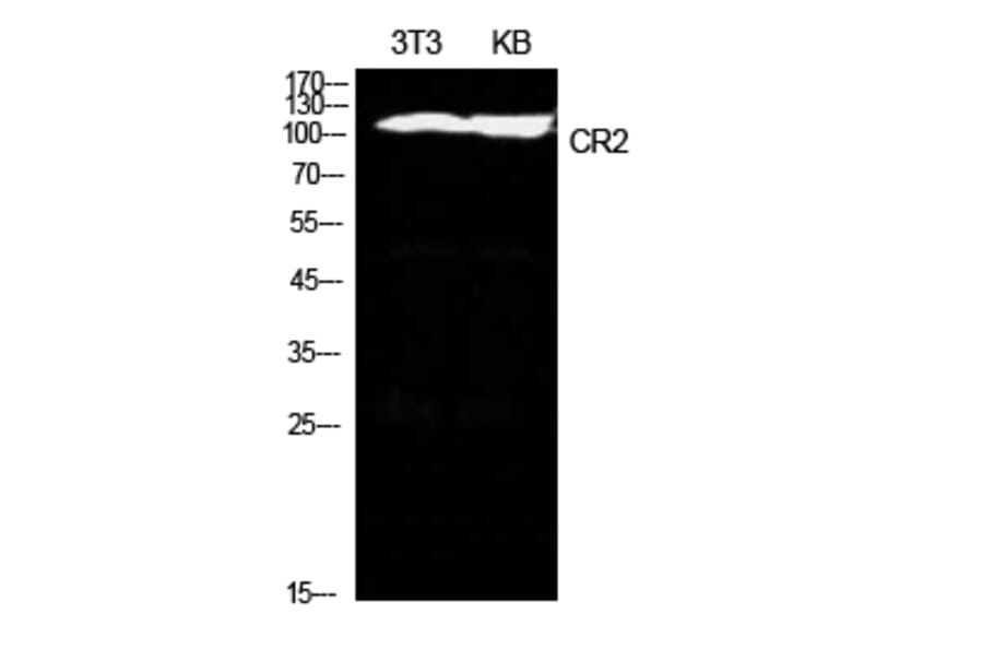 Western blot - CD21 Polyclonal Antibody from Signalway Antibody (41948) - Antibodies.com