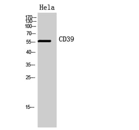 Western blot - CD39 Polyclonal Antibody from Signalway Antibody (41951) - Antibodies.com