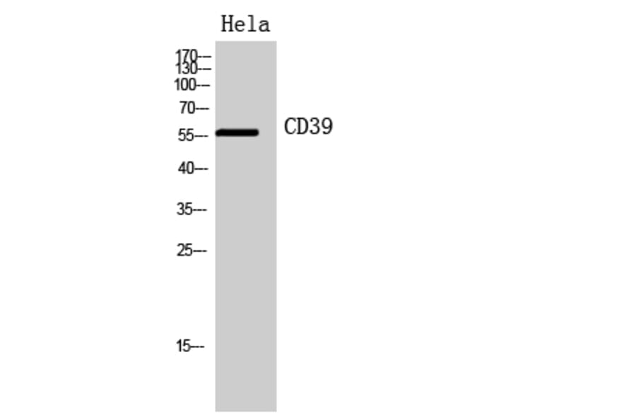 Western blot - CD39 Polyclonal Antibody from Signalway Antibody (41951) - Antibodies.com