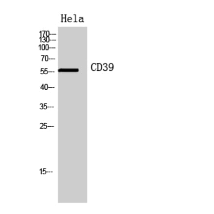 Western blot - CD39 Polyclonal Antibody from Signalway Antibody (41951) - Antibodies.com