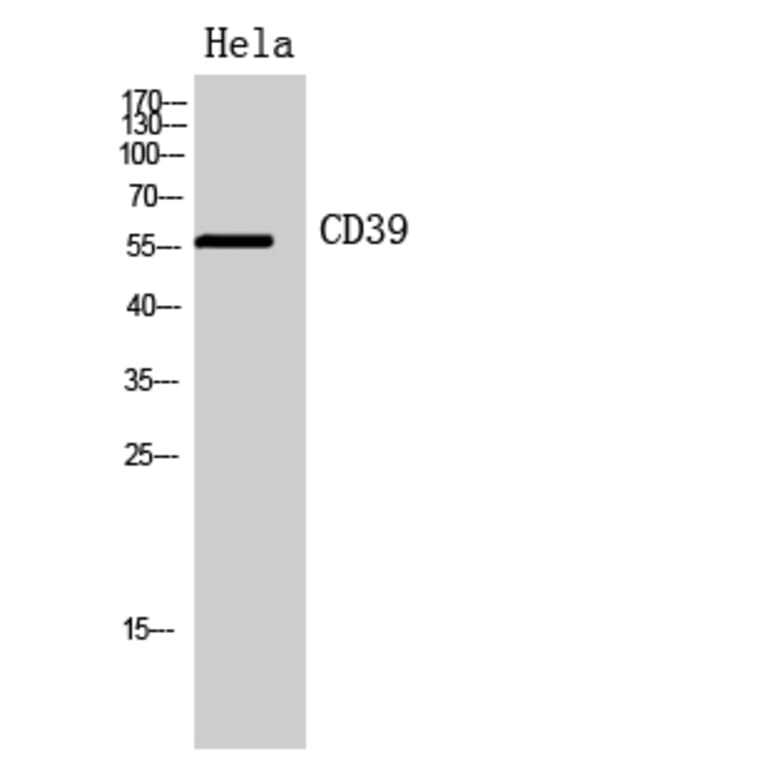 Western blot - CD39 Polyclonal Antibody from Signalway Antibody (41951) - Antibodies.com