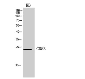 Western blot - CD53 Polyclonal Antibody from Signalway Antibody (41956) - Antibodies.com