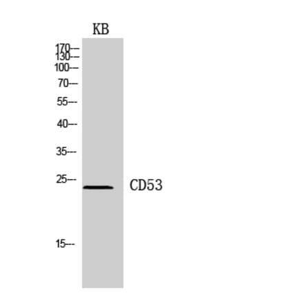 Western blot - CD53 Polyclonal Antibody from Signalway Antibody (41956) - Antibodies.com