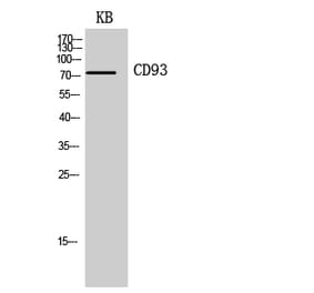 Western blot - CD93 Polyclonal Antibody from Signalway Antibody (41962) - Antibodies.com