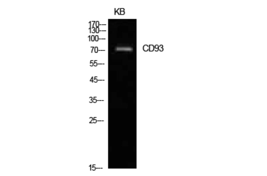 Western blot - CD93 Polyclonal Antibody from Signalway Antibody (41962) - Antibodies.com