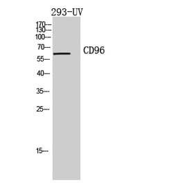 Western blot - CD96 Polyclonal Antibody from Signalway Antibody (41963) - Antibodies.com