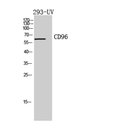 Western blot - CD96 Polyclonal Antibody from Signalway Antibody (41963) - Antibodies.com