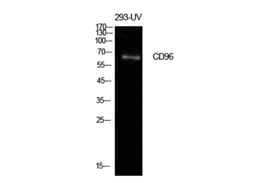 Western blot - CD96 Polyclonal Antibody from Signalway Antibody (41963) - Antibodies.com
