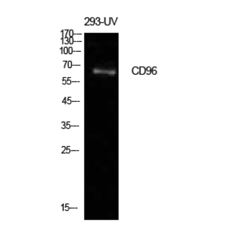 Western blot - CD96 Polyclonal Antibody from Signalway Antibody (41963) - Antibodies.com