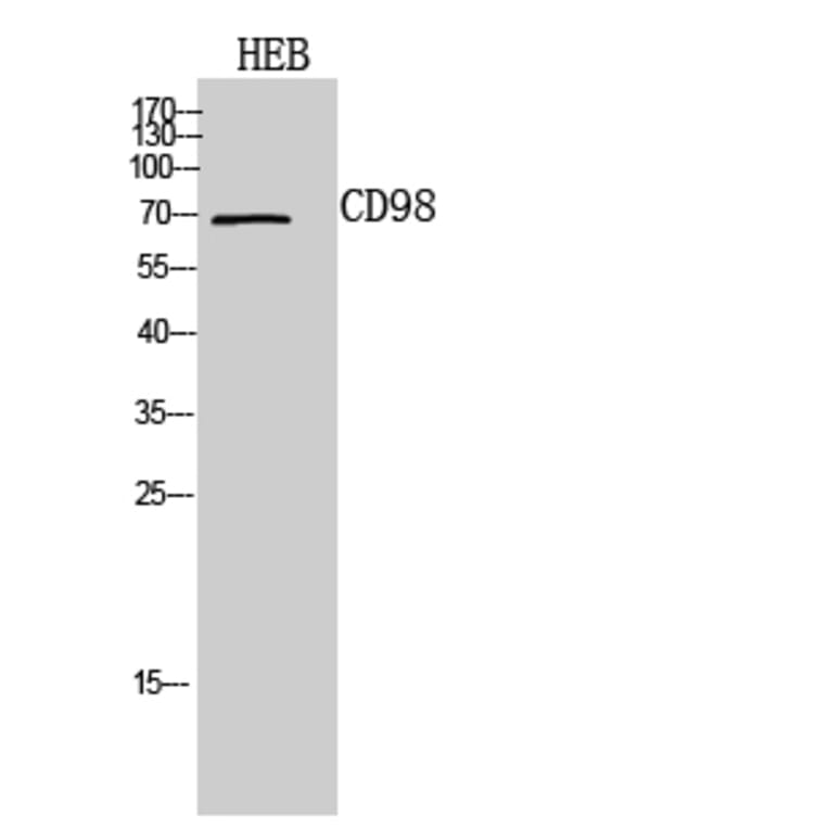 Western blot - CD98 Polyclonal Antibody from Signalway Antibody (41964) - Antibodies.com