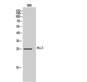 Western blot - Ebi3 Polyclonal Antibody from Signalway Antibody (42009) - Antibodies.com