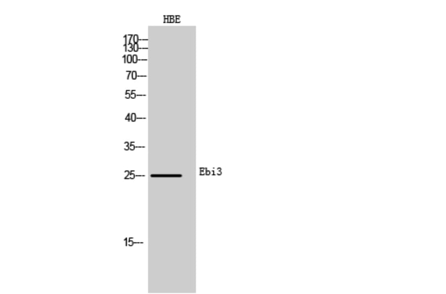 Western blot - Ebi3 Polyclonal Antibody from Signalway Antibody (42009) - Antibodies.com