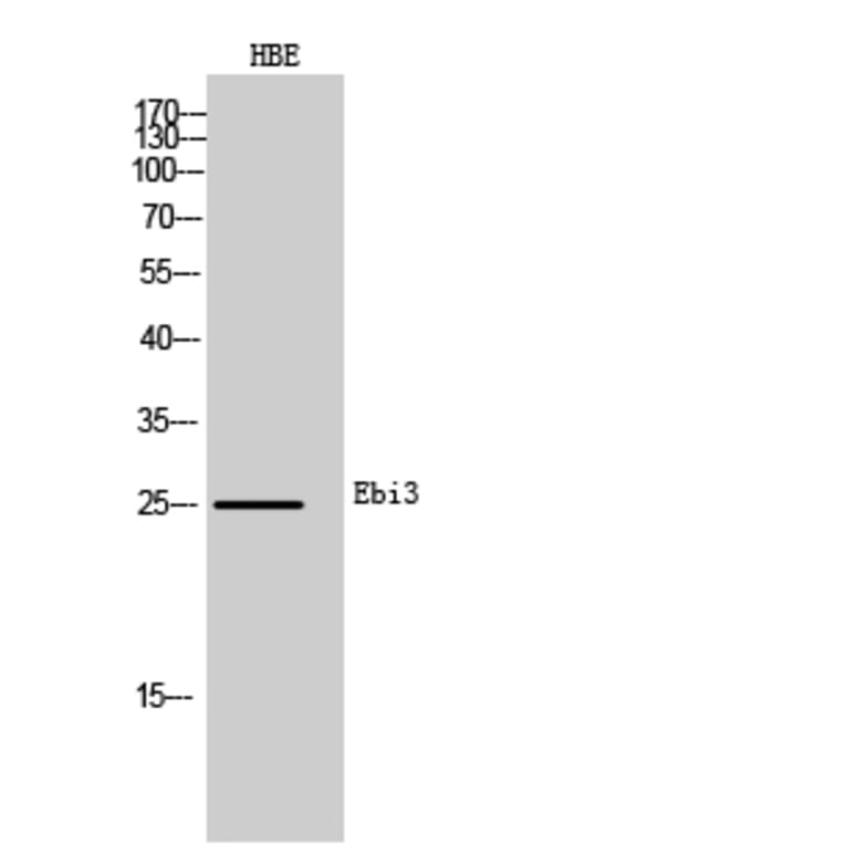 Western blot - Ebi3 Polyclonal Antibody from Signalway Antibody (42009) - Antibodies.com