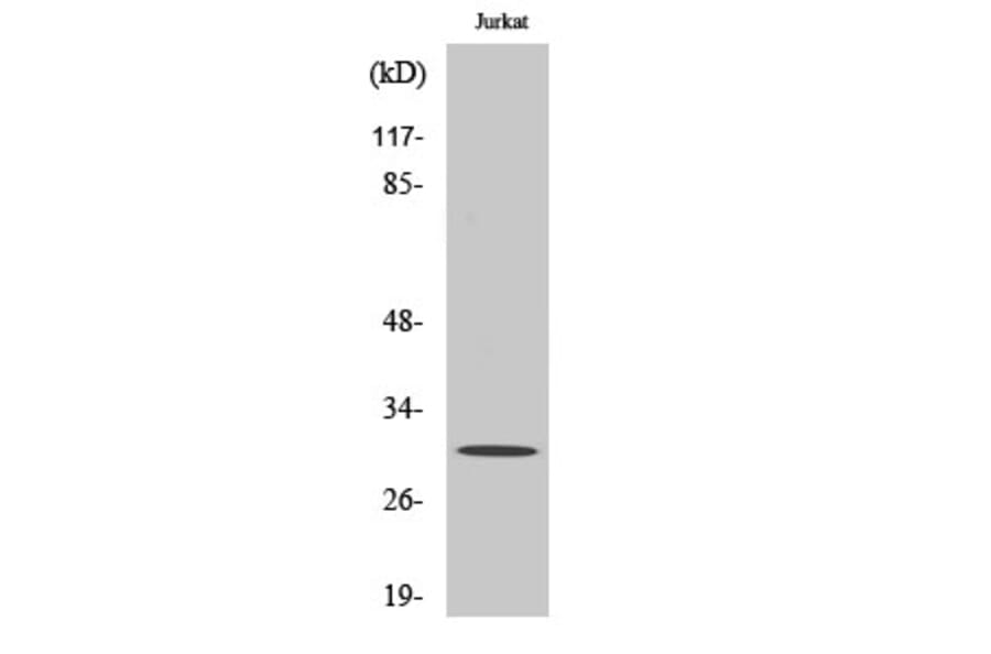 Western blot - CSP Polyclonal Antibody from Signalway Antibody (40789) - Antibodies.com