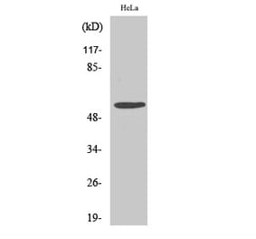 Western blot - Fyn Polyclonal Antibody from Signalway Antibody (40943) - Antibodies.com