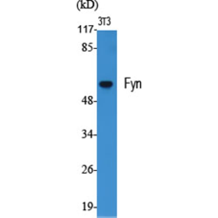 Western blot - Fyn Polyclonal Antibody from Signalway Antibody (40943) - Antibodies.com
