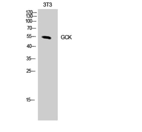 Western blot - GCK Polyclonal Antibody from Signalway Antibody (40955) - Antibodies.com