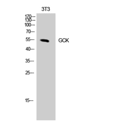 Western blot - GCK Polyclonal Antibody from Signalway Antibody (40955) - Antibodies.com