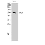 Western blot - GCK Polyclonal Antibody from Signalway Antibody (40955) - Antibodies.com