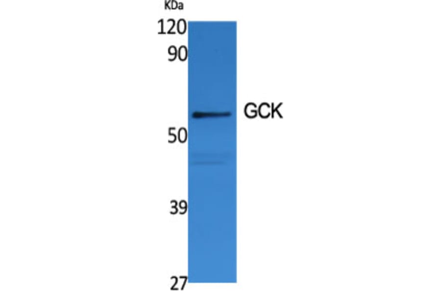 Western blot - GCK Polyclonal Antibody from Signalway Antibody (40955) - Antibodies.com