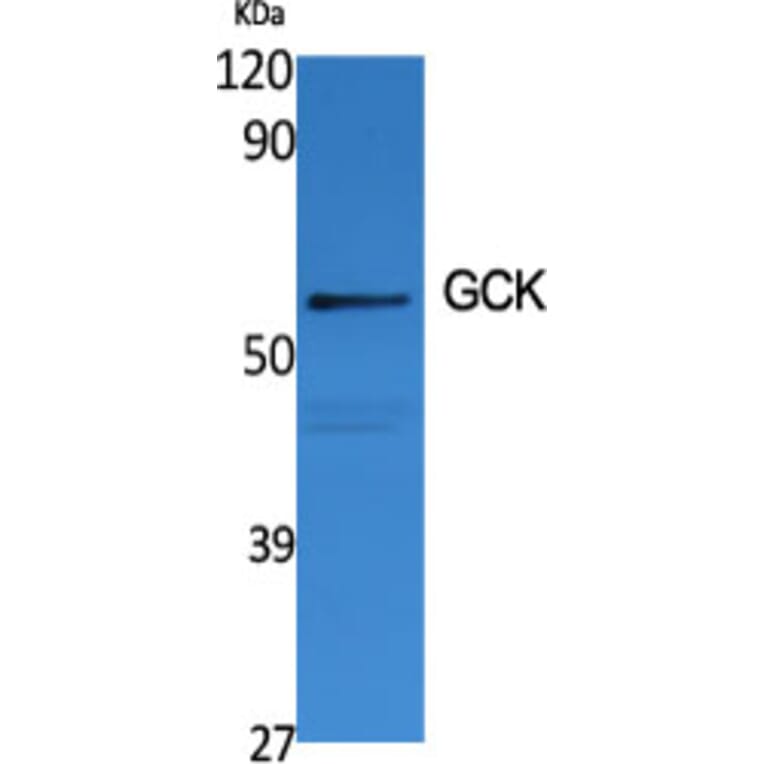 Western blot - GCK Polyclonal Antibody from Signalway Antibody (40955) - Antibodies.com