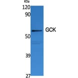 Western blot - GCK Polyclonal Antibody from Signalway Antibody (40955) - Antibodies.com