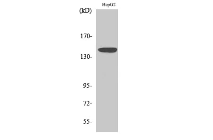 Western blot - Met Polyclonal Antibody from Signalway Antibody (41140) - Antibodies.com