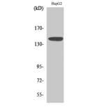 Western blot - Met Polyclonal Antibody from Signalway Antibody (41140) - Antibodies.com