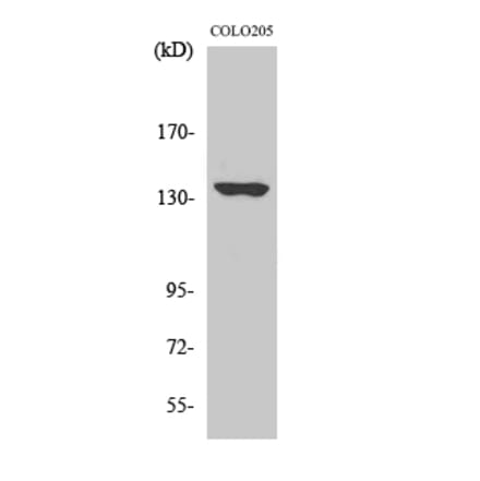 Western blot - MN1 Polyclonal Antibody from Signalway Antibody (41158) - Antibodies.com