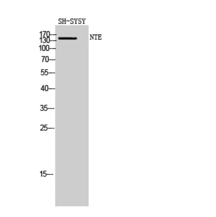 Western blot - NTE Polyclonal Antibody from Signalway Antibody (41256) - Antibodies.com