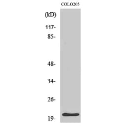 Western blot - p21 Polyclonal Antibody from Signalway Antibody (41297) - Antibodies.com