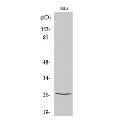 Western blot - p27 Polyclonal Antibody from Signalway Antibody (41300) - Antibodies.com