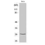 Western blot - p27 Polyclonal Antibody from Signalway Antibody (41300) - Antibodies.com