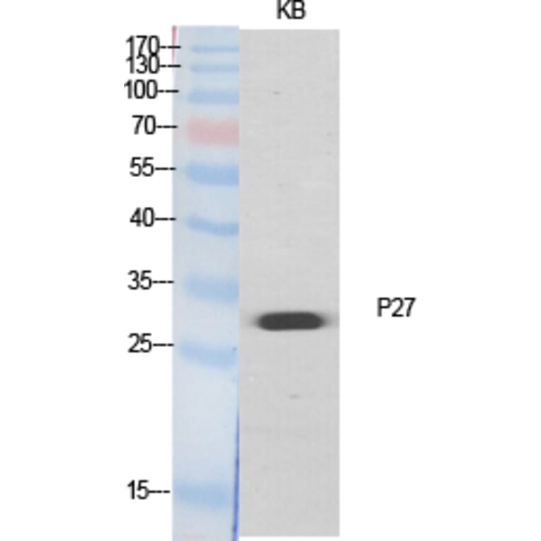 Western blot - p27 Polyclonal Antibody from Signalway Antibody (41300) - Antibodies.com