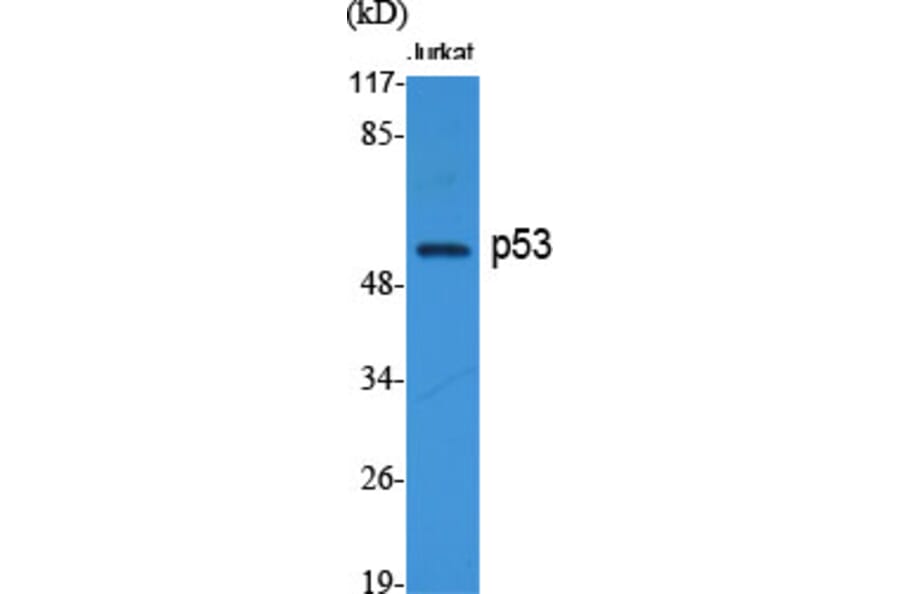 Western blot - p53 Polyclonal Antibody from Signalway Antibody (41309) - Antibodies.com