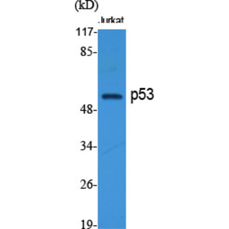 Western blot - p53 Polyclonal Antibody from Signalway Antibody (41309) - Antibodies.com