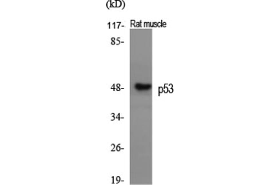 Western blot - p53 Polyclonal Antibody from Signalway Antibody (41311) - Antibodies.com