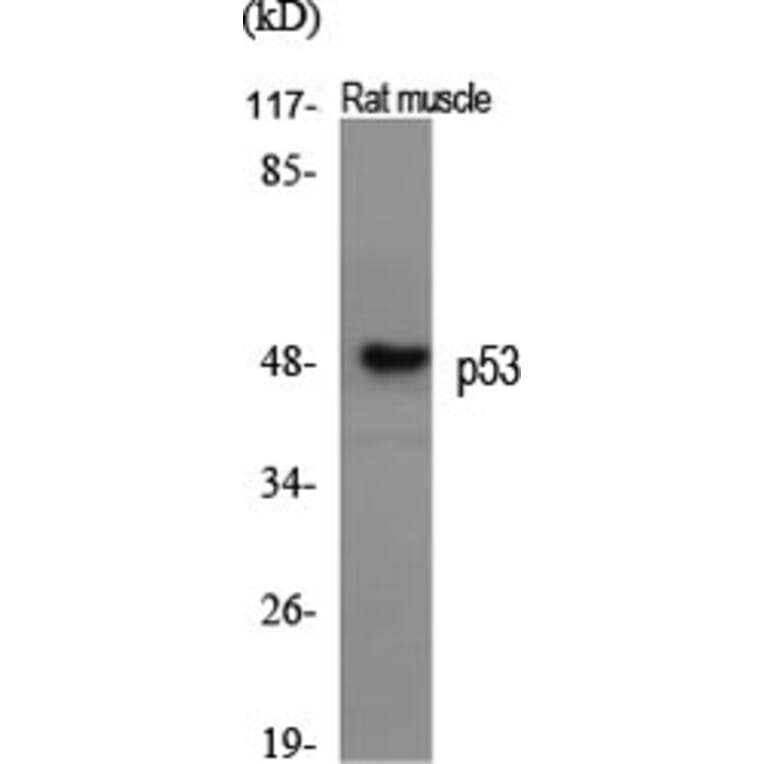 Western blot - p53 Polyclonal Antibody from Signalway Antibody (41311) - Antibodies.com