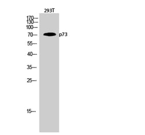 Western blot - p73 Polyclonal Antibody from Signalway Antibody (41319) - Antibodies.com