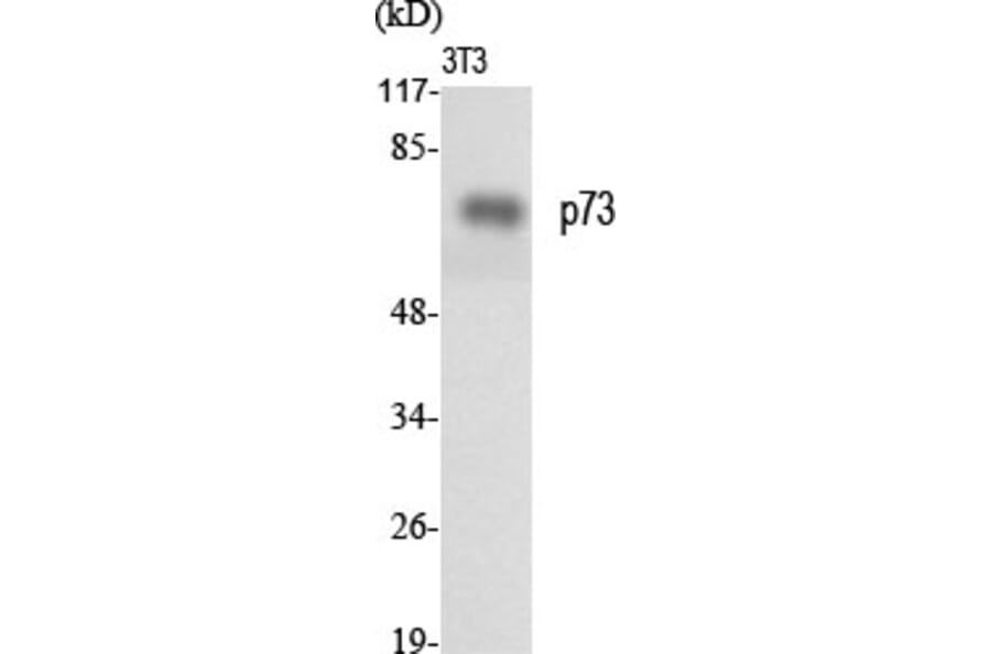 Western blot - p73 Polyclonal Antibody from Signalway Antibody (41319) - Antibodies.com