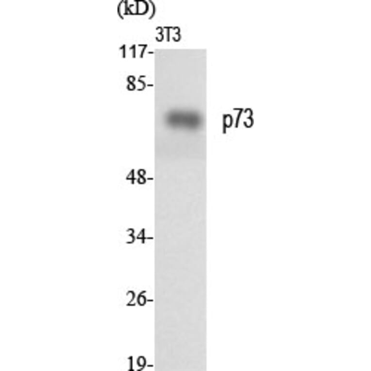 Western blot - p73 Polyclonal Antibody from Signalway Antibody (41319) - Antibodies.com