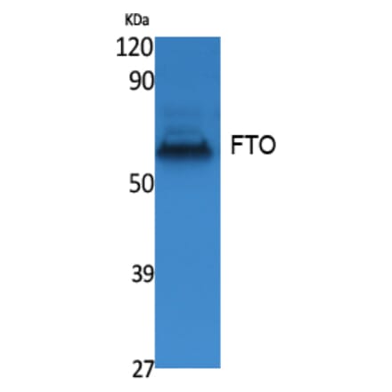 Western blot - FTO Polyclonal Antibody from Signalway Antibody (41548) - Antibodies.com